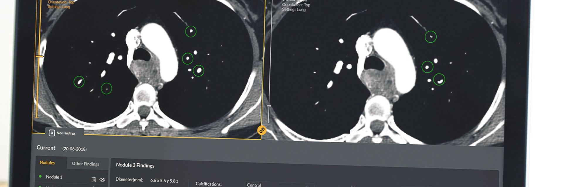 Nextgen Ventures invests 500k in smart learning solution